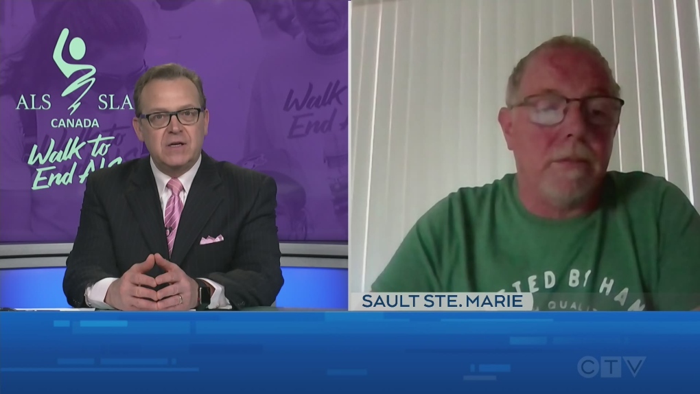 Sault Ste. Marie Man Shares Story About Having ALS